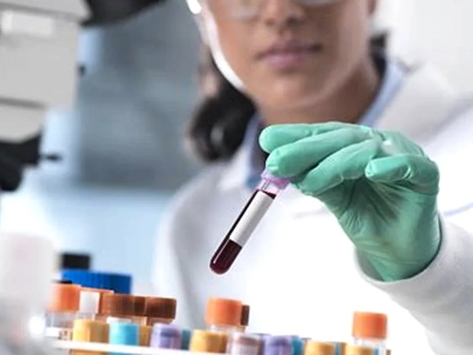 Editorial photograph of a modern laboratory blood test vial